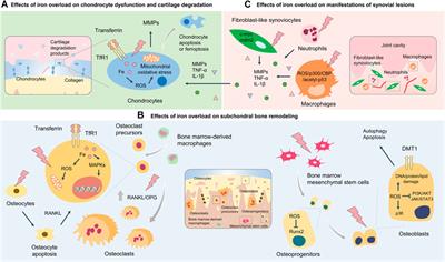 Interplay Between Iron Overload and Osteoarthritis: Clinical Significance and Cellular Mechanisms